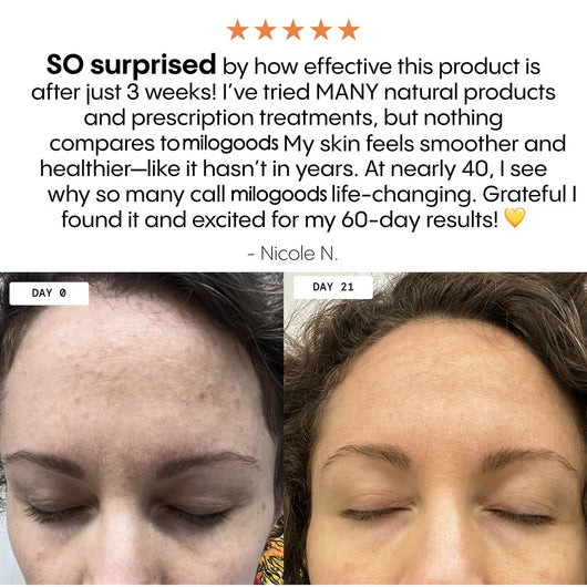 The Complete System for Mature Women’s Skin